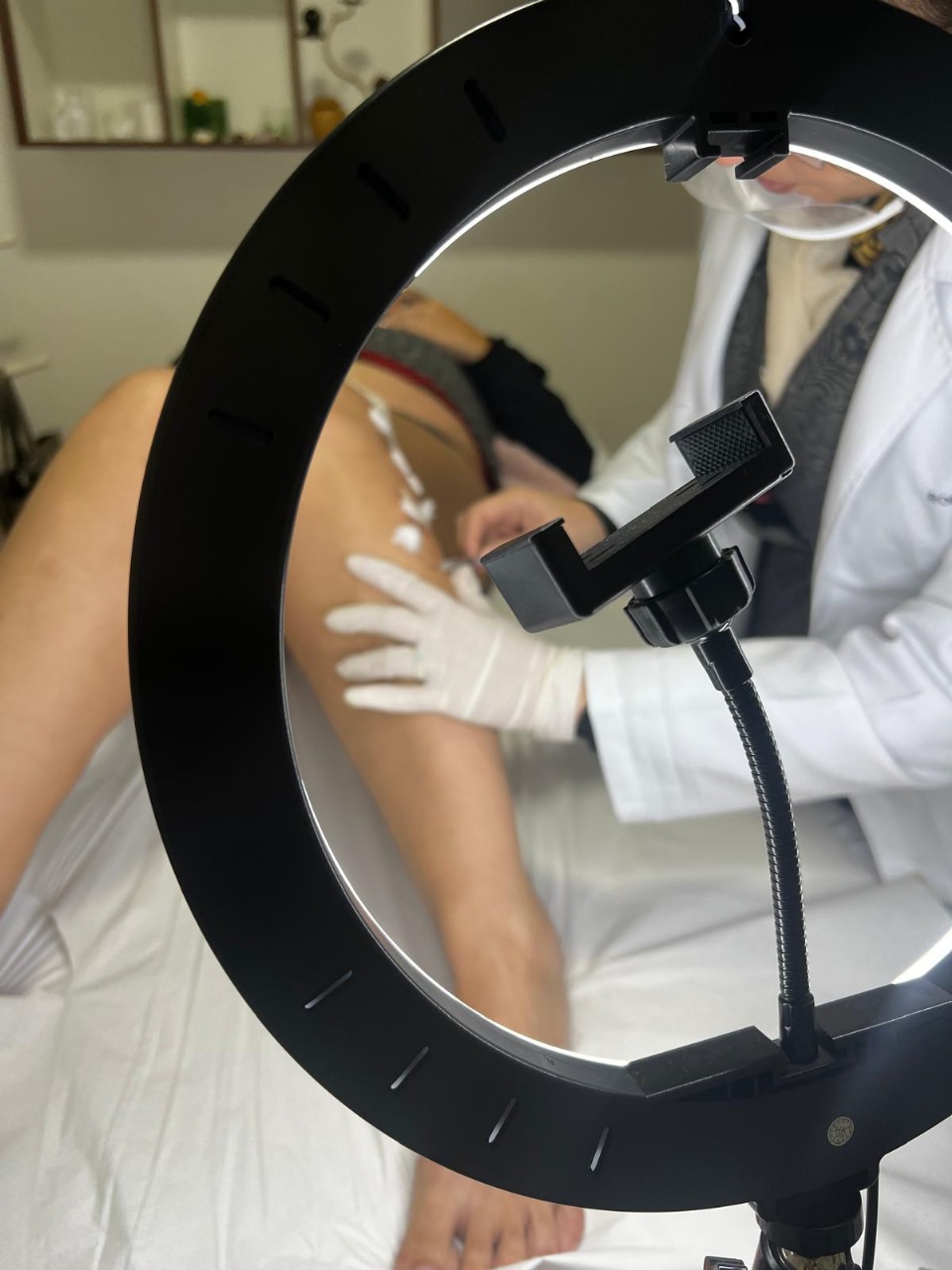 Inverno é aliado para secar vasinhos: estação favorece tratamentos estéticos e resultados rápidos